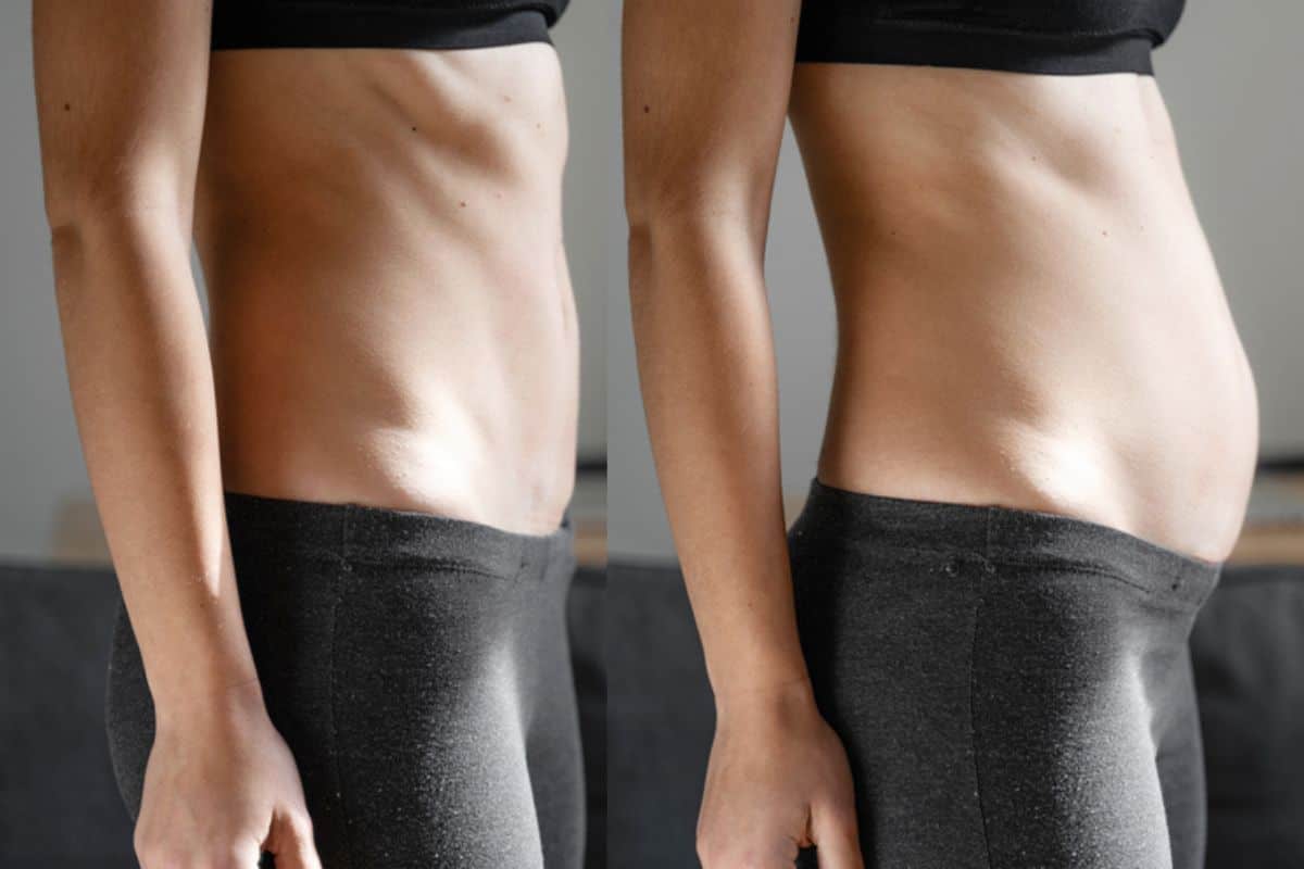 How long does diastasis recti take to improve Chester-le-Street?