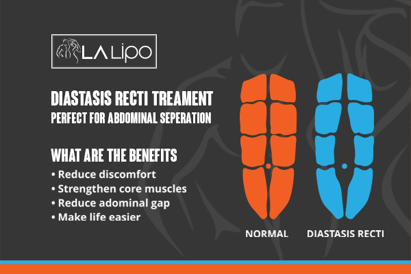 When Should You Consider Professional Help for Core Recovery Chester-le-Street